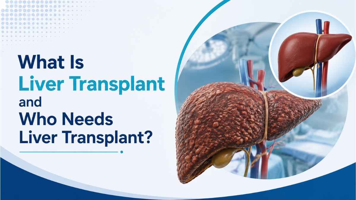 what is liver transplant
